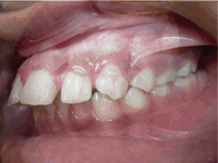 Clic sobre esta imagen para conocer más acerca de los problemas esqueléticos y dentales